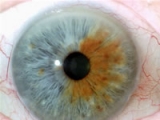 Iridologa: los ojos como ventanas de la salud