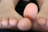 Hongos en los pies