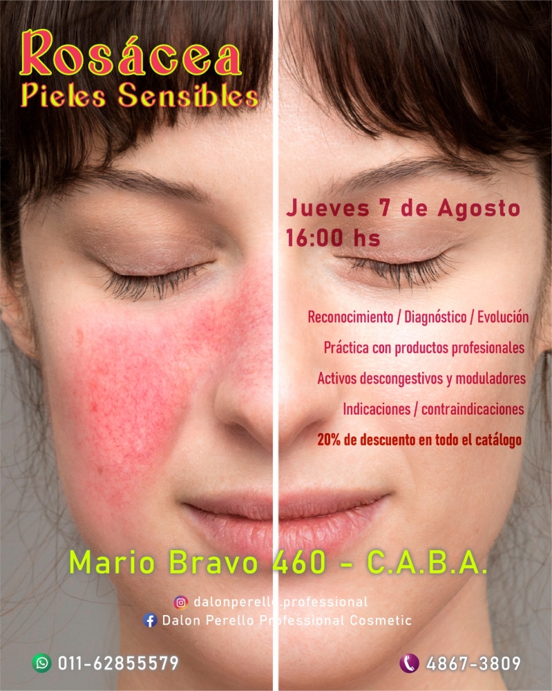 Curso > Roscea